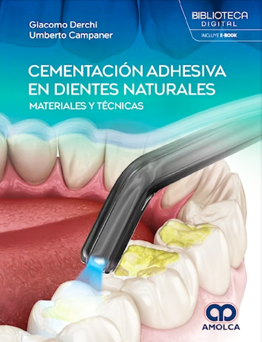 Cementación Adhesiva en Dientes Naturales. Materiales y Técnicas
